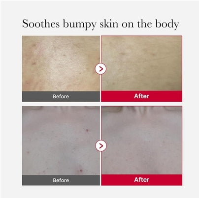 [MEDICUBE] Red Acne Body Peeling Shot 2.0 110g
