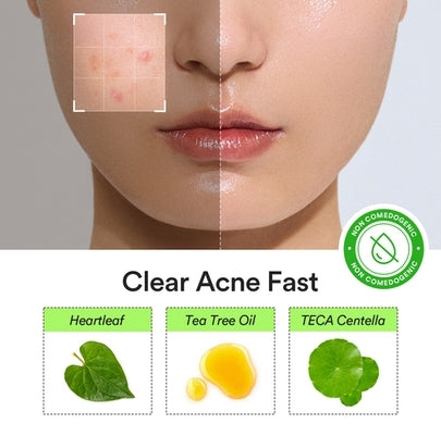 [Abib] Heartleaf Calming Spot Patch 78pcs